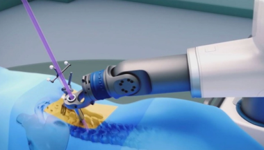 robotic arm making an incision along a fake patient's spine